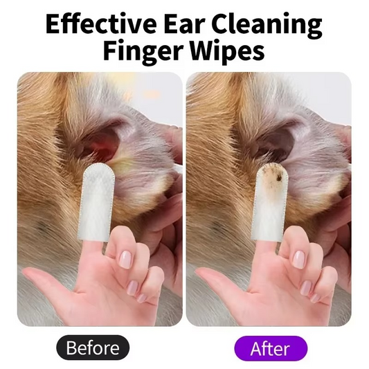 Teeth Cleaning Wipes
